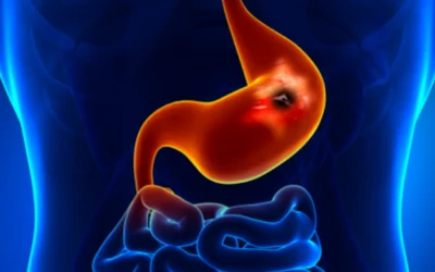 Gastric Trouble